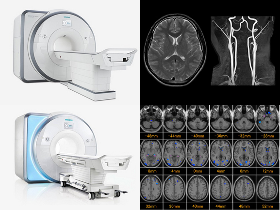 3テスラMRI・1.5テスラMRI・頭部MRI及び頸部MRA・早期認知症チェック(VSRAD)
