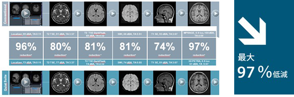 静かに撮影します。最大で従来MRIの97％、平均で84％ 騒音をカットします。