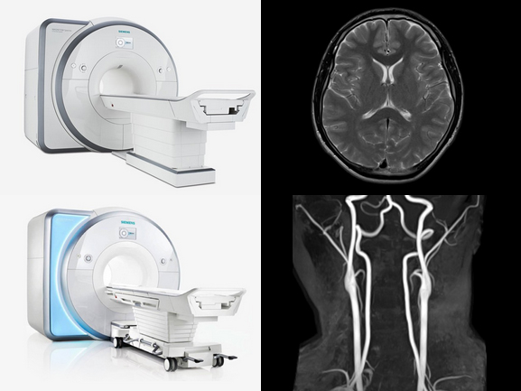 3テスラMRI・1.5テスラMRI・頭部MRI・頸部MRA